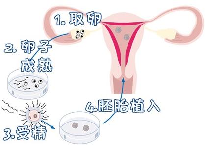 代生男孩包性别生殖医学中心